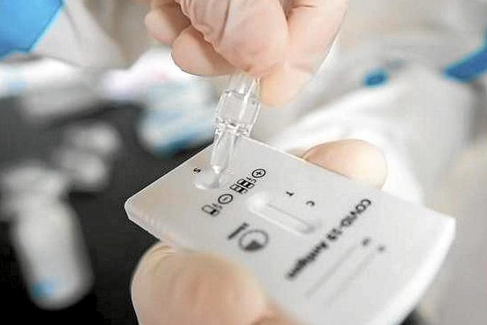 Un sanitario manipula un test de antígenos.