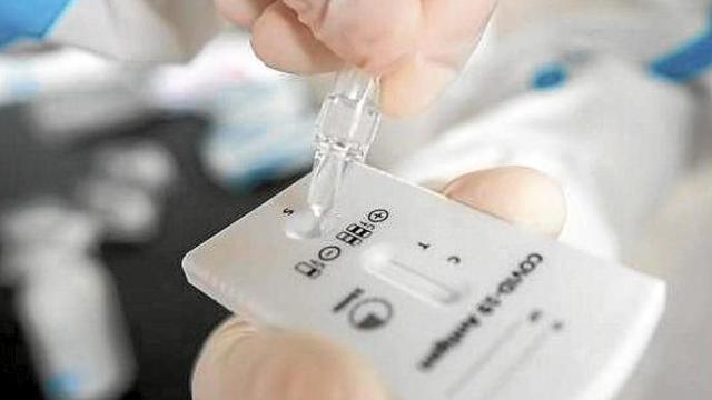 Un sanitario manipula un test de antígenos. Un sanitario manipula un test de antígenos.