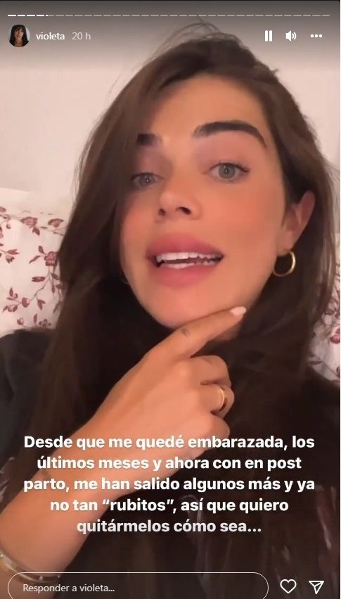 Violeta Mangriñán habla de su complejo facial.