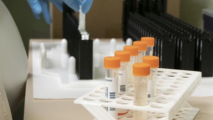 Imagen de varias pruebas PCR para la detección de viruela del mono.