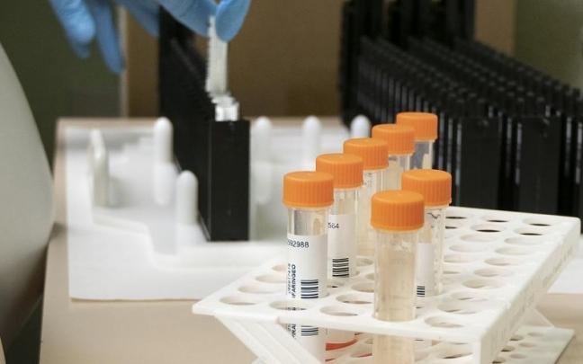 Imagen de varias pruebas PCR para la detección de viruela del mono. Imagen de varias pruebas PCR para la detección de viruela del mono.