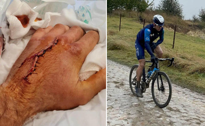 A la izquierda, la mano de Erviti tras la operación. A la derecha, el ciclista navarro durante la París-Roubaix.