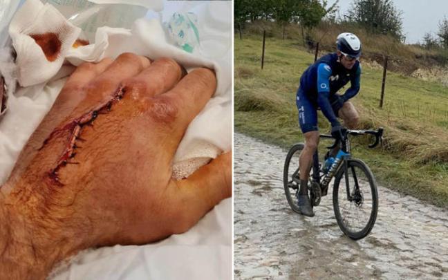 A la izquierda, la mano de Erviti tras la operación. A la derecha, el ciclista navarro durante la París-Roubaix.