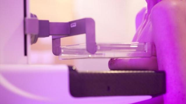 Test genómico a operadas de cáncer de mama.