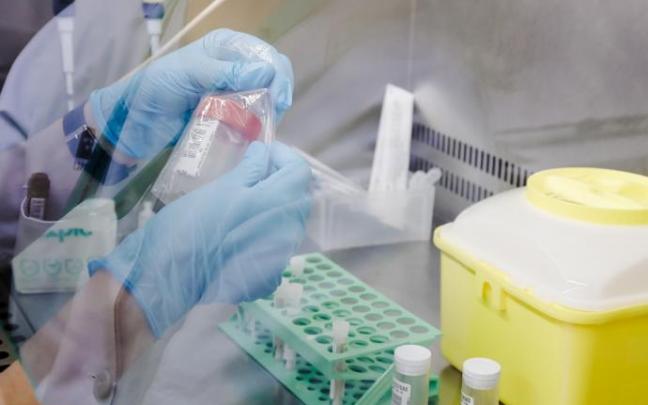 Una técnico de laboratorio sostiene una de las pruebas de análisis para la viruela del mono.