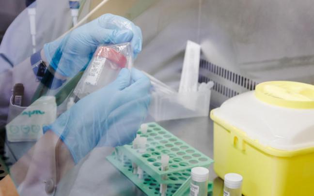 Una técnico de laboratorio sostiene una de las pruebas de análisis para la viruela del mono.