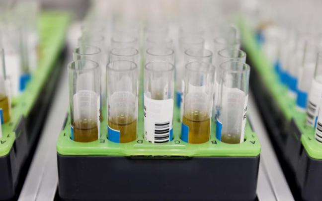 Probetas de pruebas PCR para detectar la infección.