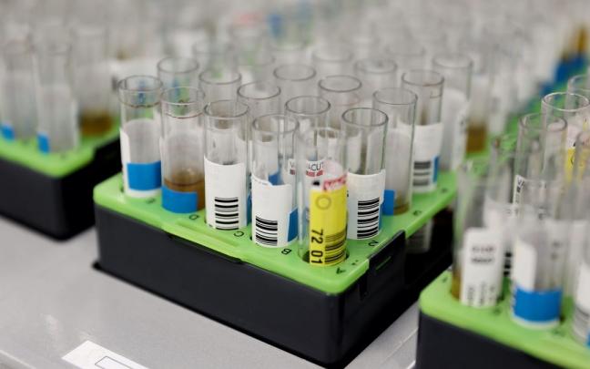 Probetas de pruebas PCR en el Laboratorio de Microbiolog&iacute;a del Hospital p&uacute;blico Gregorio Mara&ntilde;&oacute;n.