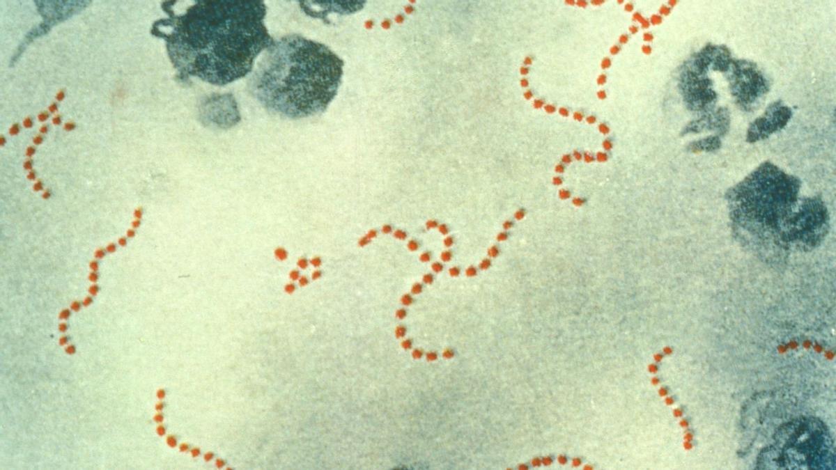 La bacteria 'Streptococcus pyogenes'.