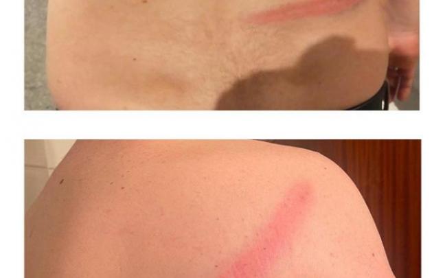 Una de las fotos de las agresiones mostradas por Bultzada en las redes sociales. Una de las fotos de las agresiones mostradas por Bultzada en las redes sociales.
