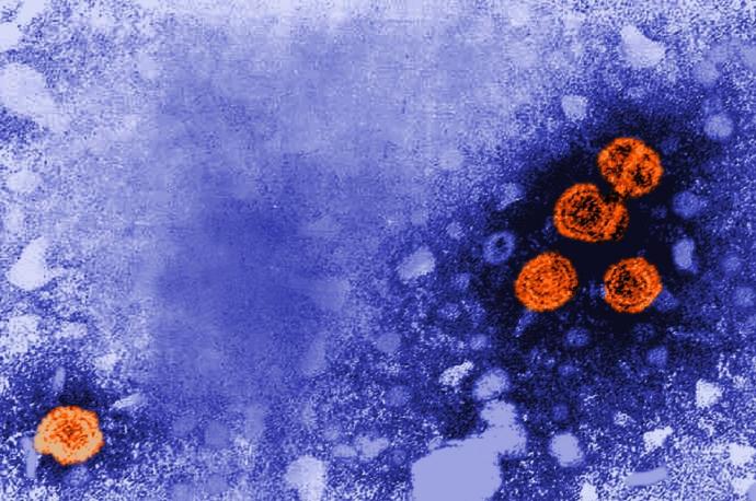Imagen de microscopía electrónica de transmisión coloreada digitalmente revela la presencia de viriones de la hepatitis B