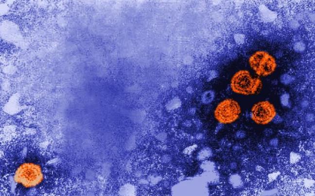 Imagen de microscopía electrónica de transmisión coloreada digitalmente revela la presencia de viriones de la hepatitis B Imagen de microscopía electrónica de transmisión coloreada digitalmente revela la presencia de viriones de la hepatitis B