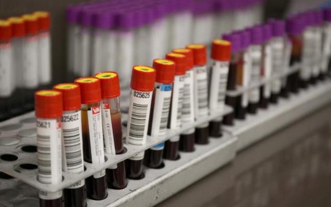 Tubos con sangre extraída en la Asociación de Donantes de Sangre de Gipuzkoa. Tubos con sangre extraída en la Asociación de Donantes de Sangre de Gipuzkoa.