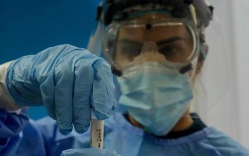 Personal sanitario prepara un test para realizar una PCR.