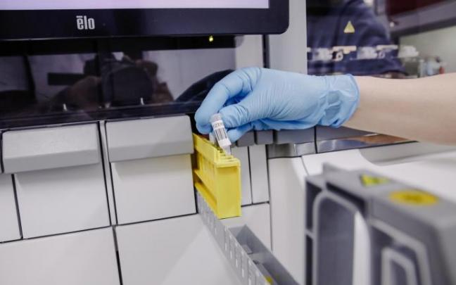 Pruebas de viruela del mono.