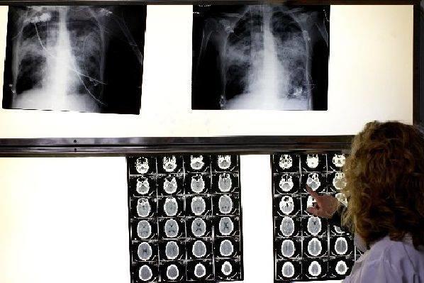 Una doctora consulta unas radiografías.