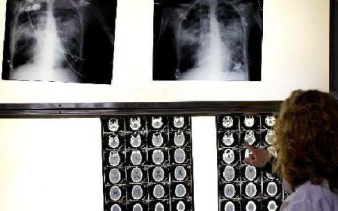 Una doctora consulta unas radiografías. Una doctora consulta unas radiografías.