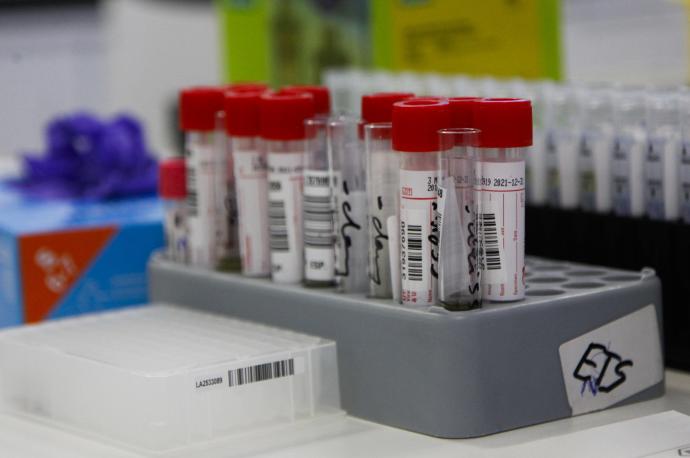 Tubos con muestras tomadas para realizar un test PCR de detección del coronavirus.