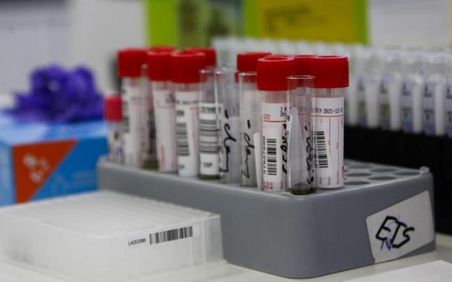 Tubos con muestras tomadas para realizar un test PCR de detección del coronavirus.