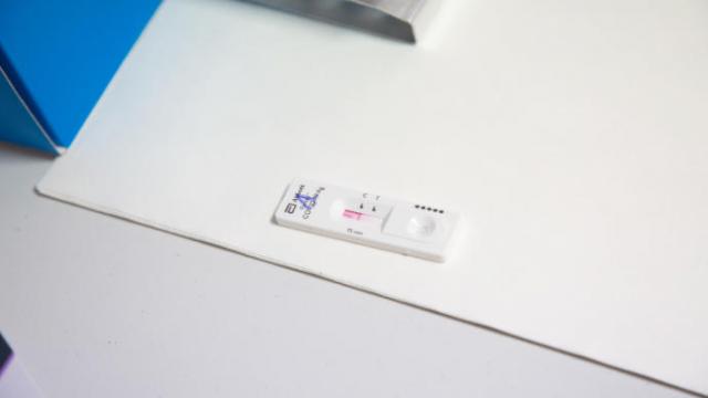 Prueba de un test de antígenos