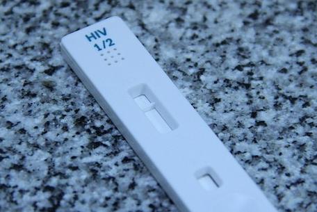 Imagen de archivo de un test rápido de VIH.