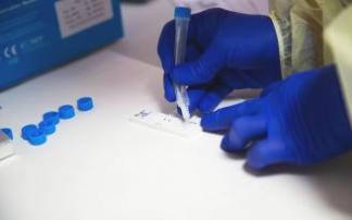 Un test para detectar el Covid-19.