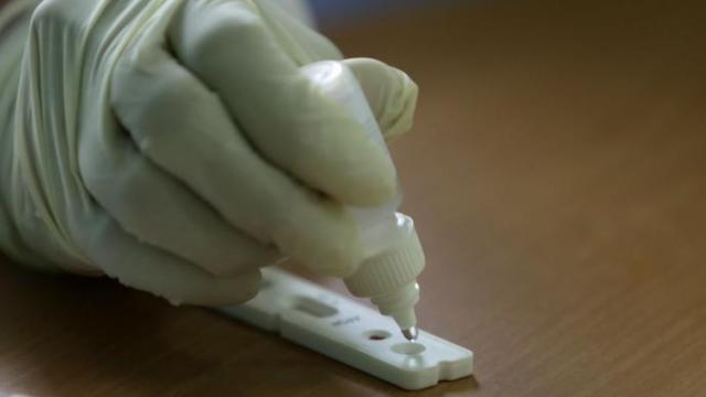 Carolina Darias ha anunciado que se va a autorizar la venta en farmacias sin prescripción médica de los test de autodiagnóstico de la covid-19