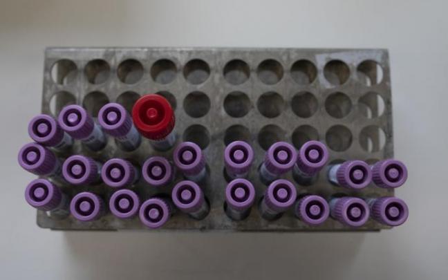 Imagen de unas pruebas covid