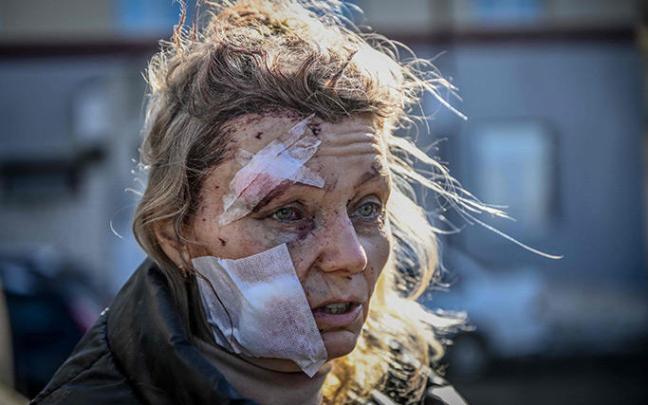 Una mujer con heridas causadas por un bombardeo en la ciudad ucraniana de Chuguiv.