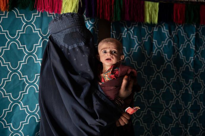 Una madre con su bebé de siete meses, desnutrido, en Kandahar