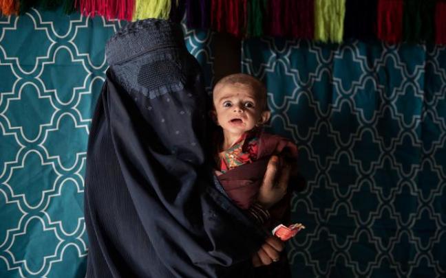 Una madre con su bebé de siete meses, desnutrido, en Kandahar Una madre con su bebé de siete meses, desnutrido, en Kandahar