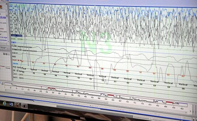 La Unidad del Sueño de la OSI Araba trata a 1.600 nuevos pacientes al año