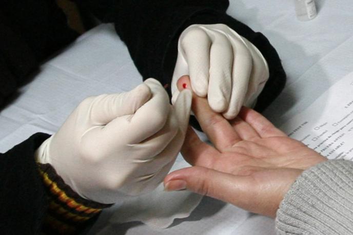 Una prueba de detección de VIH