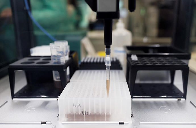 Probetas de pruebas PCR en el Laboratorio de Microbiología del Hospital público Gregorio Marañón.