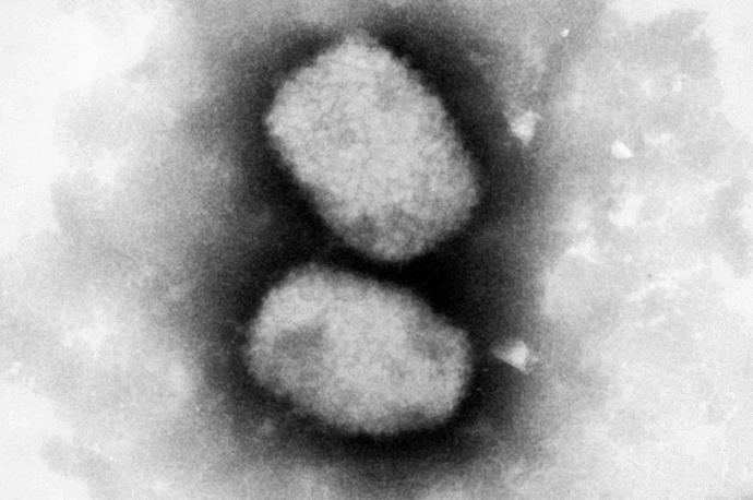 Virus de la viruela del mono.