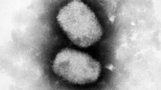 Virus de la viruela del mono. Virus de la viruela del mono.