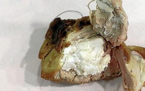 Trozo de carne con veneno localizada en Soraluze. Foto: Policía Municipal